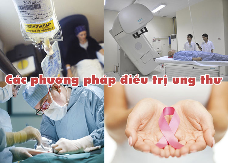 Các phương pháp điều trị ung thư